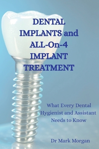 Dental Implants and All-On-4 Implant Treatment
