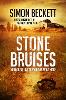 Stone Bruises